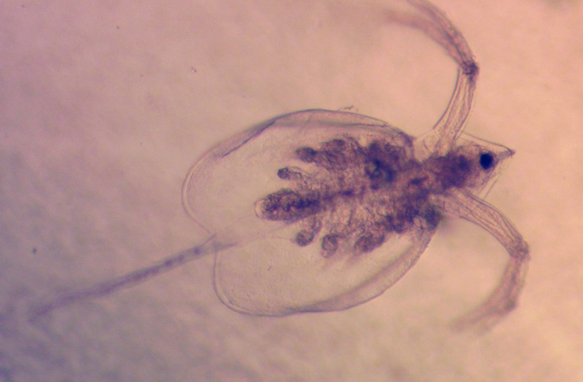 Zooplankton as it appears under a microscope.